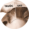 Dầu gội kích thích mọc tóc